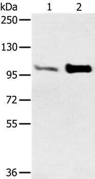 ACTN2 Antibody