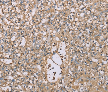SCN1B Antibody