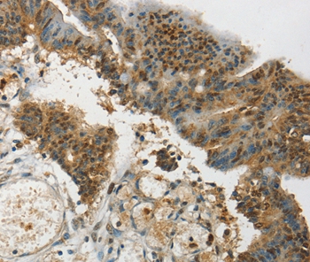 SYCP1 Antibody