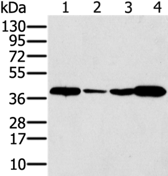 SYCP3 Antibody
