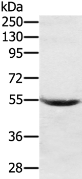 SERPING1 Antibody