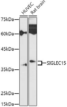 SIGLEC15 Antibody