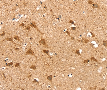 SRP68 Antibody