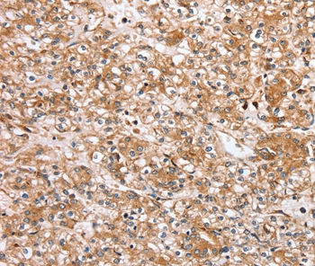 SLC25A20 Antibody