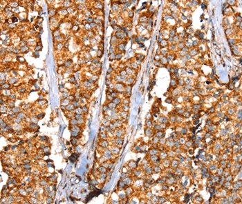 SLC25A3 Antibody