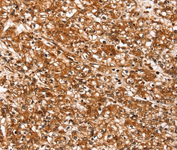 SLC26A5 Antibody