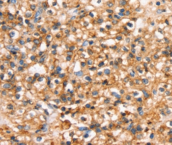 SLC34A3 Antibody