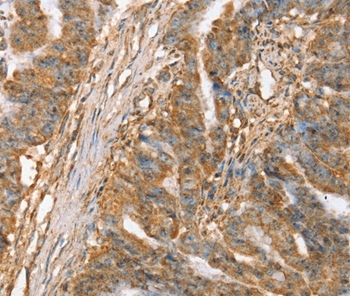 SLC41A3 Antibody