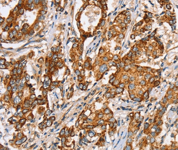 SLC5A11 Antibody