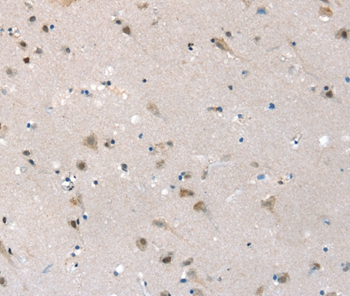 SLC6A7 Antibody