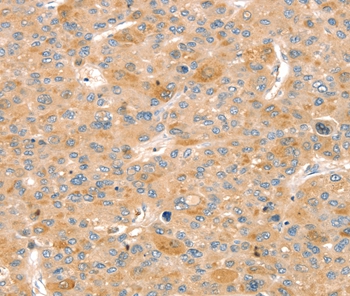 SLIT3 Antibody