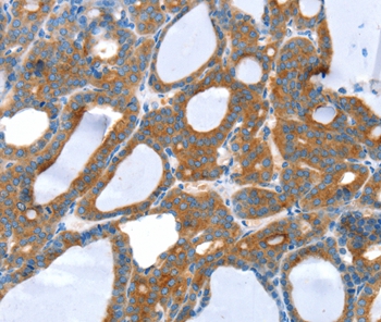 SNX5 Antibody