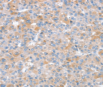 SNX25 Antibody