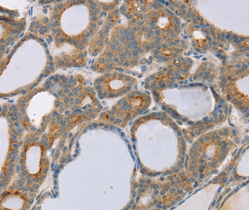 SNX30 Antibody