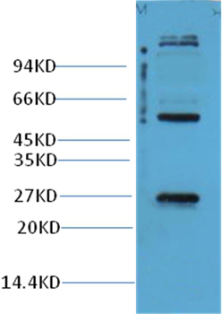 EFHD1 Rabbit Polyclonal Antibody