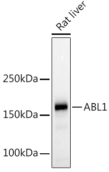 ABL1 antibody