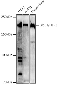 ERBB3 antibody