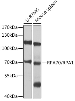 RPA1 antibody