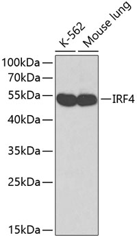IRF4 antibody