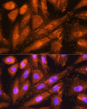 PSMD4 antibody