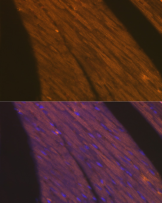 TNNT2 antibody
