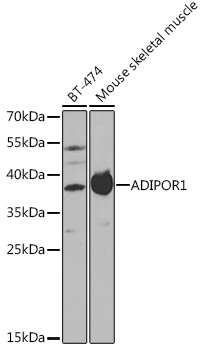 ADIPOR1 antibody