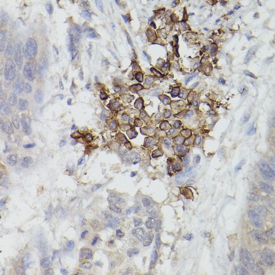 CD38 antibody