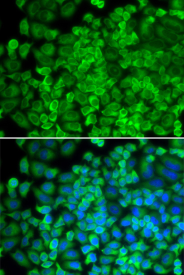 GLA antibody