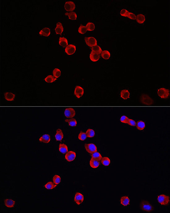 NTRK2 antibody