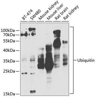 UBB antibody