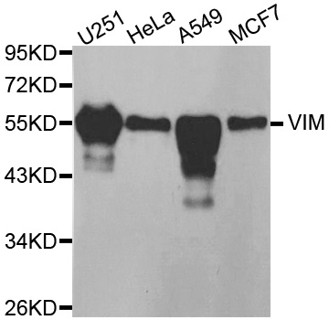VIM antibody