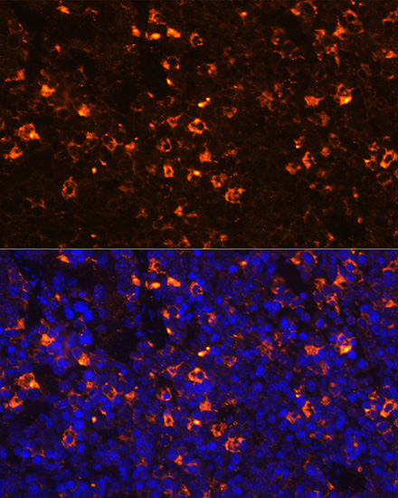 CLEC4D antibody