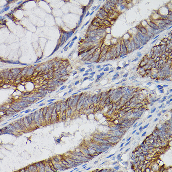 IL18R1 antibody