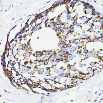 PDCD10 antibody