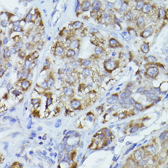 CPT2 antibody