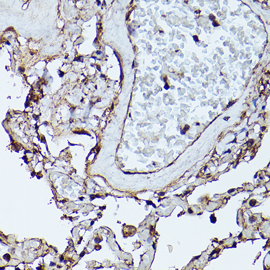 CTGF antibody