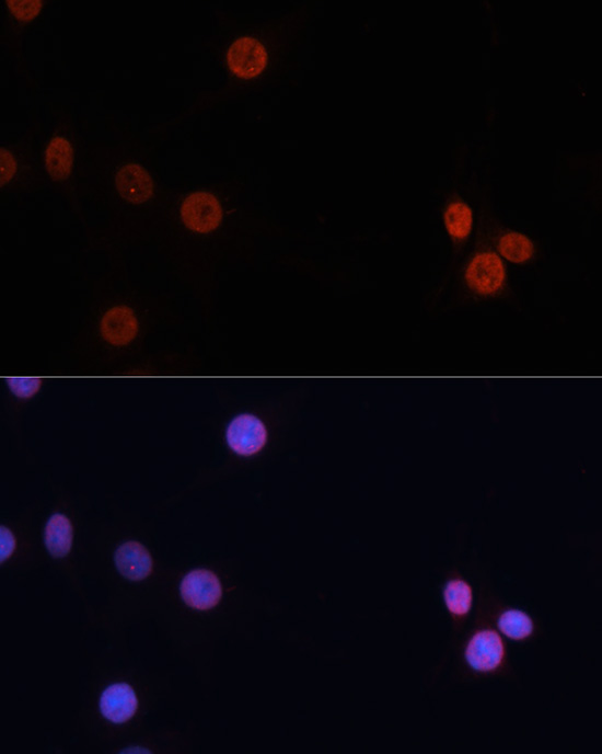 DNMT3B antibody