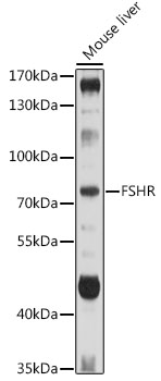 FSHR antibody