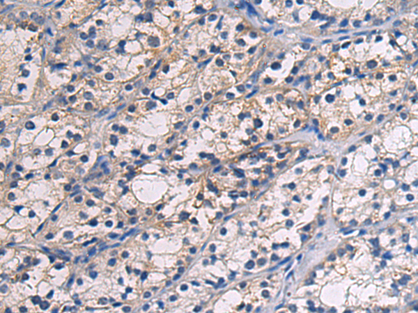 HIC1 antibody