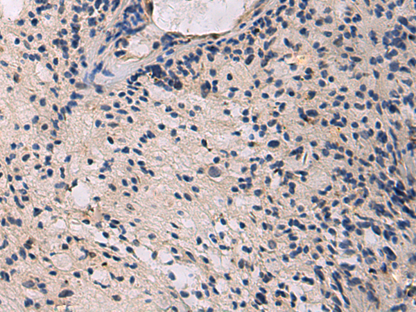 HECTD2 antibody