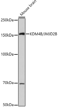 KDM4B antibody
