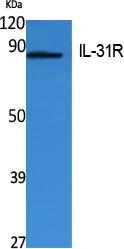 IL31RA antibody