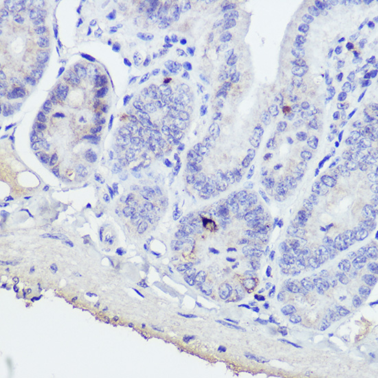 GIP antibody