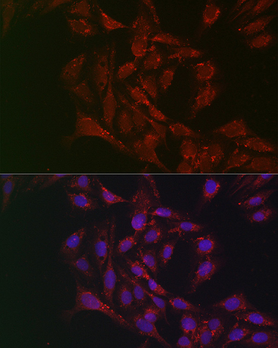 PNPLA2 antibody