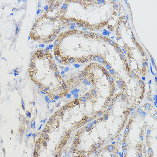 CYP51A1 antibody