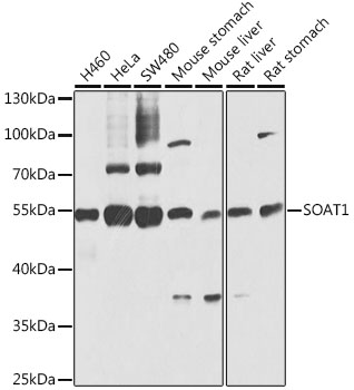 SOAT1 antibody