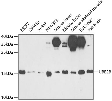 UBE2B antibody