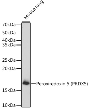 PRDX5 antibody