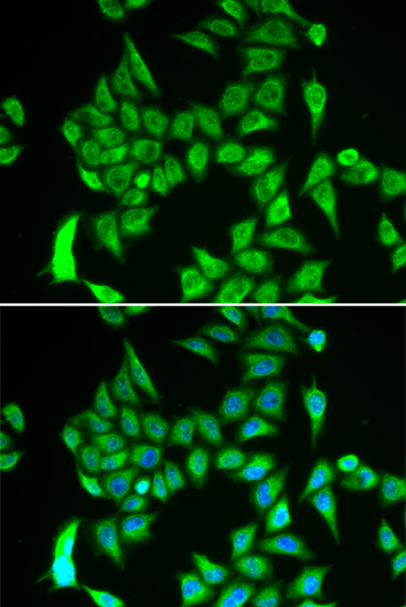 IREB2 antibody
