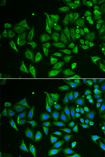 CLEC3B antibody
